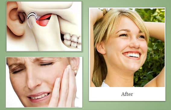 hilton head tmj disorder