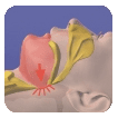 Hilton Head Sleep Apnea 2