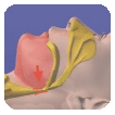 Hilton Head Sleep Apnea 1